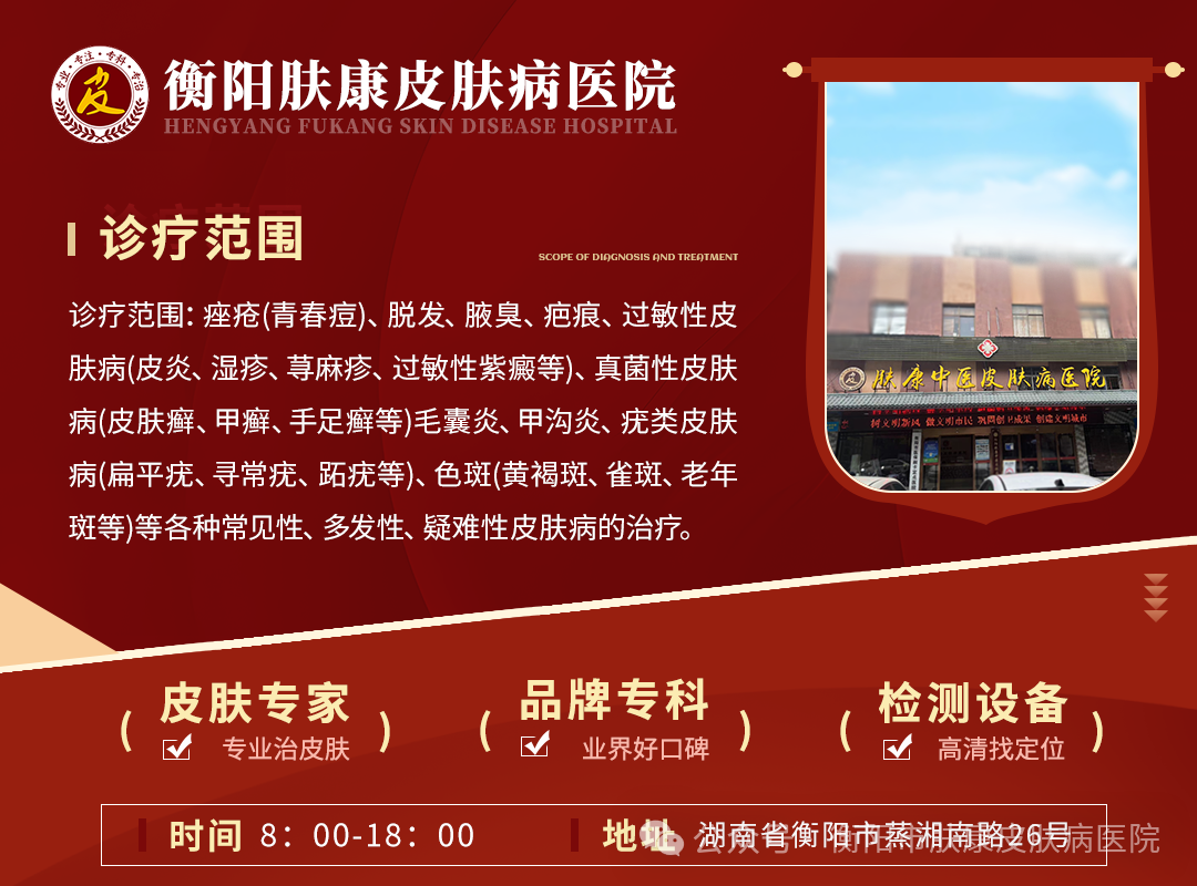 人未老头先秃——脂溢性脱发患者应该如何自救？防止脱发​！