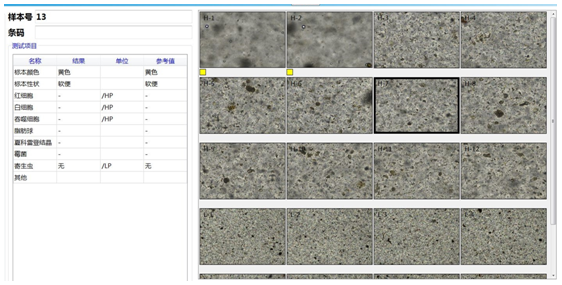 粪便常规仪器怎么用一场“大追踪”！引起嗜酸性粒细胞增高的真正原因是……_https://www.jmylbn.com_新闻资讯_第18张