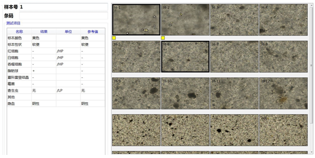 粪便常规仪器怎么用一场“大追踪”！引起嗜酸性粒细胞增高的真正原因是……_https://www.jmylbn.com_新闻资讯_第8张