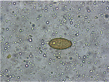 粪便常规仪器怎么用一场“大追踪”！引起嗜酸性粒细胞增高的真正原因是……_https://www.jmylbn.com_新闻资讯_第19张