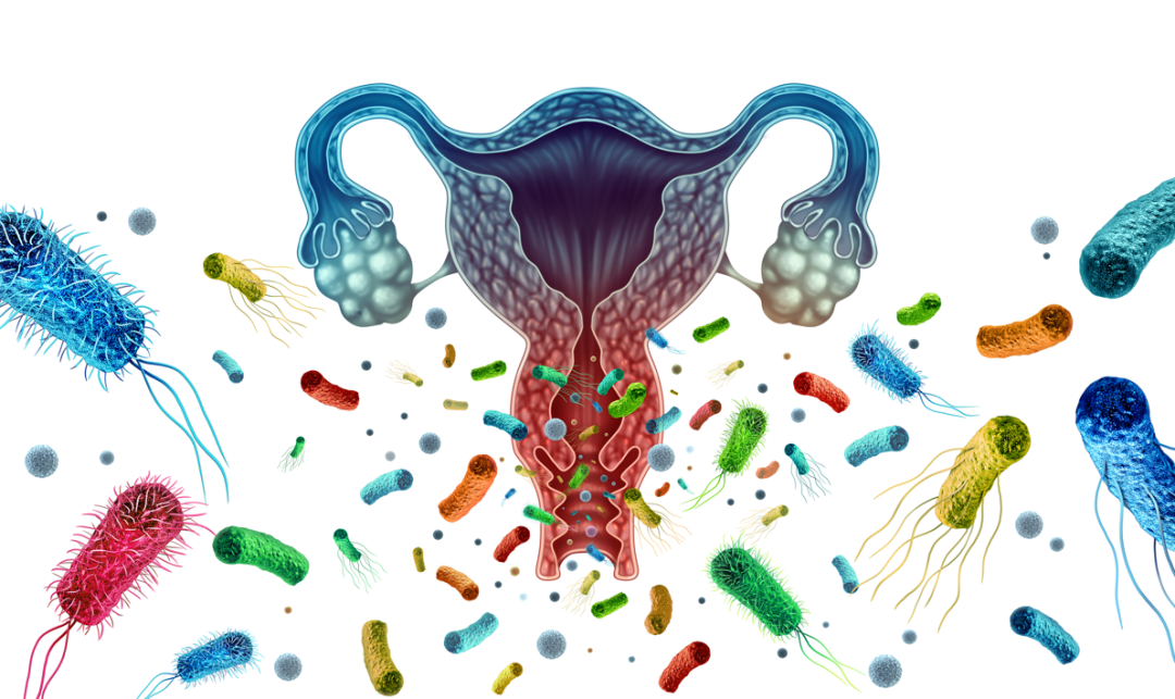 bv唾液酸酶阴性什么意思BV不容忽视，竟可诱发早产_https://www.jmylbn.com_新闻资讯_第3张