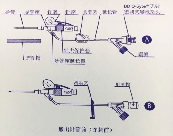 下图为bd留置针两种不同型号在穿刺前和穿刺后的结构介绍.