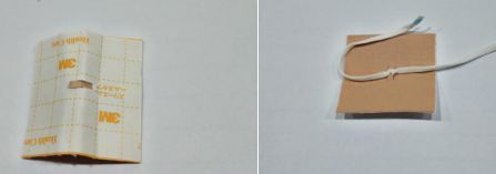 尿管怎么固定尿管固定别小看5cm，却是“血”的差距！_https://www.jmylbn.com_新闻资讯_第7张