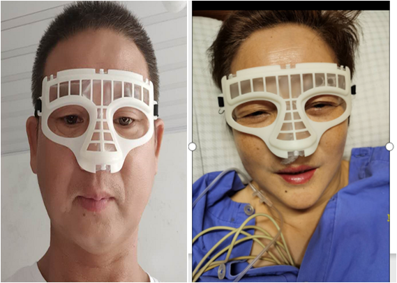 普通留置针怎么固定这个护理创新太小巧，护士用过都说好！_https://www.jmylbn.com_新闻资讯_第14张