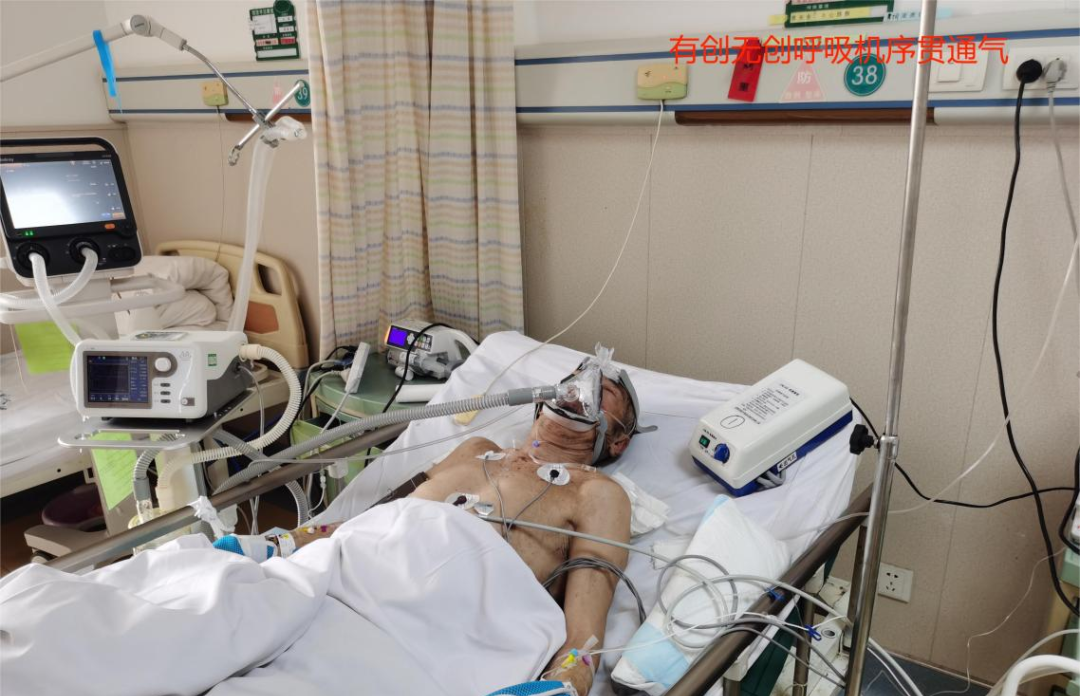 什么是有创呼吸机图片院区动态 ｜ 抢救生命，争分夺秒——泊里院区运用有创呼吸机成功抢救呼吸危重症患者_https://www.jmylbn.com_新闻资讯_第4张