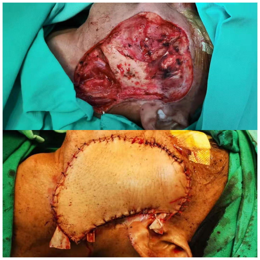 口腔无痛麻醉仪怎么用优质学科速览——第924医院口腔科_https://www.jmylbn.com_新闻资讯_第11张