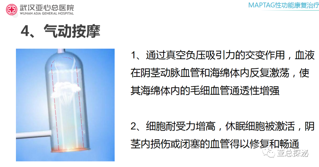 性功能康复治疗是什么性功能康复治疗_https://www.jmylbn.com_新闻资讯_第5张