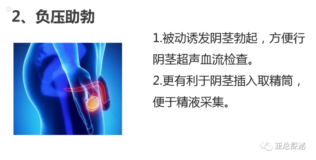 性功能康复治疗是什么性功能康复治疗_https://www.jmylbn.com_新闻资讯_第3张