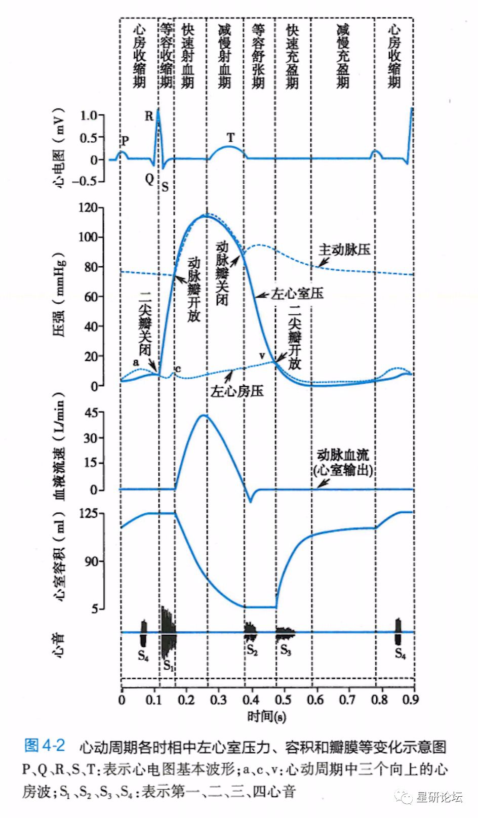 个纠错帖 关于主动脉瓣狭窄时递增递减型杂 的解读 星研论坛 微信公众号文章阅读 Wemp