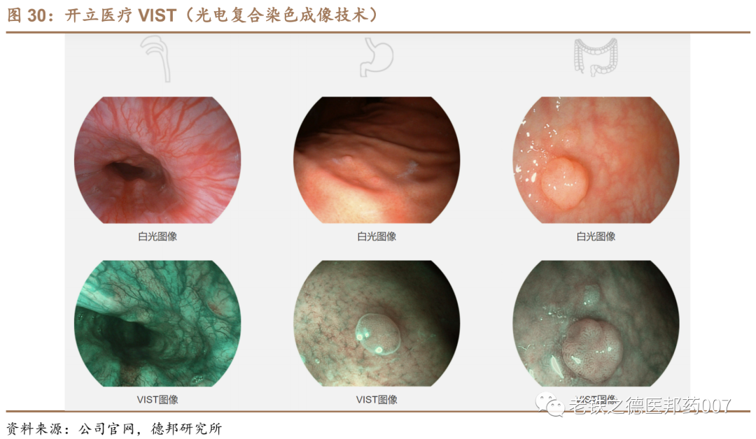 开立超声怎么样【德邦医药｜公司深度】开立医疗（300633.SZ）：超声+内镜并驱，百尺竿头迈入高端_https://www.jmylbn.com_新闻资讯_第24张