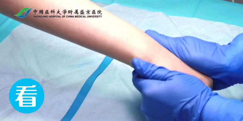 留置针怎么单手推针儿科穿刺高手总结疫情下4大留置针穿刺妙招！如何做到单手穿刺，“一针见血”？_https://www.jmylbn.com_新闻资讯_第2张