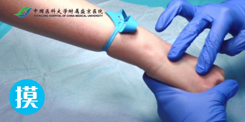 留置针怎么单手推针儿科穿刺高手总结疫情下4大留置针穿刺妙招！如何做到单手穿刺，“一针见血”？_https://www.jmylbn.com_新闻资讯_第4张