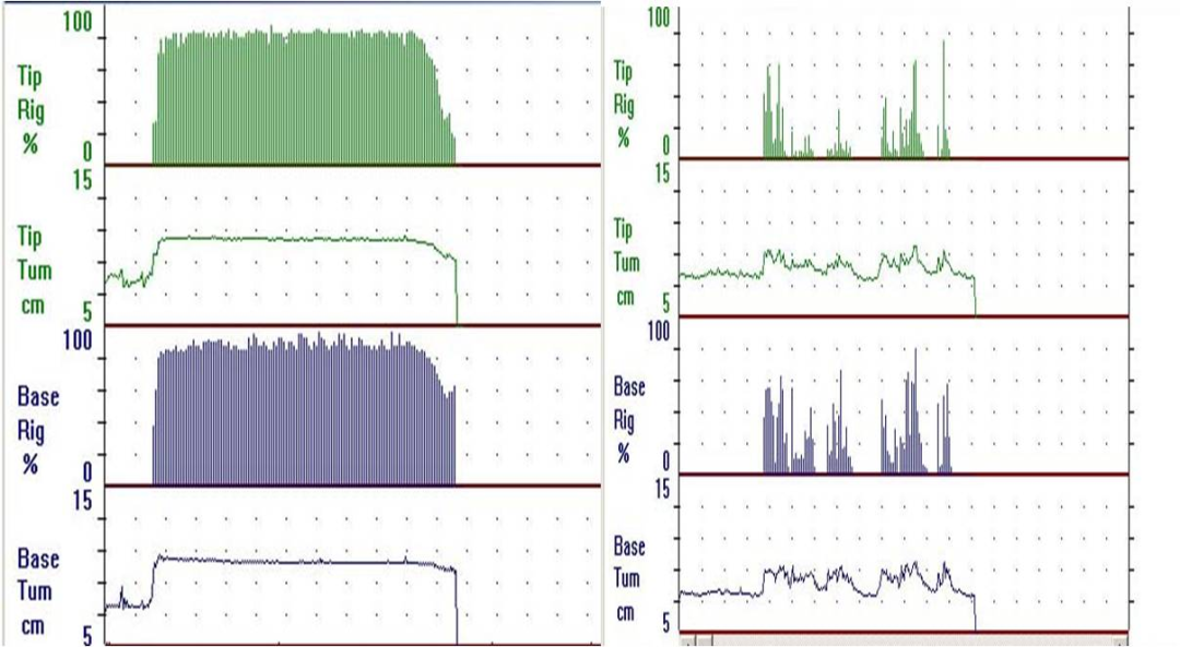 什么是性功能检测仪ED专用诊断设备—美国RigiScan阴茎硬度测量仪｜郑州博大医院_https://www.jmylbn.com_新闻资讯_第5张