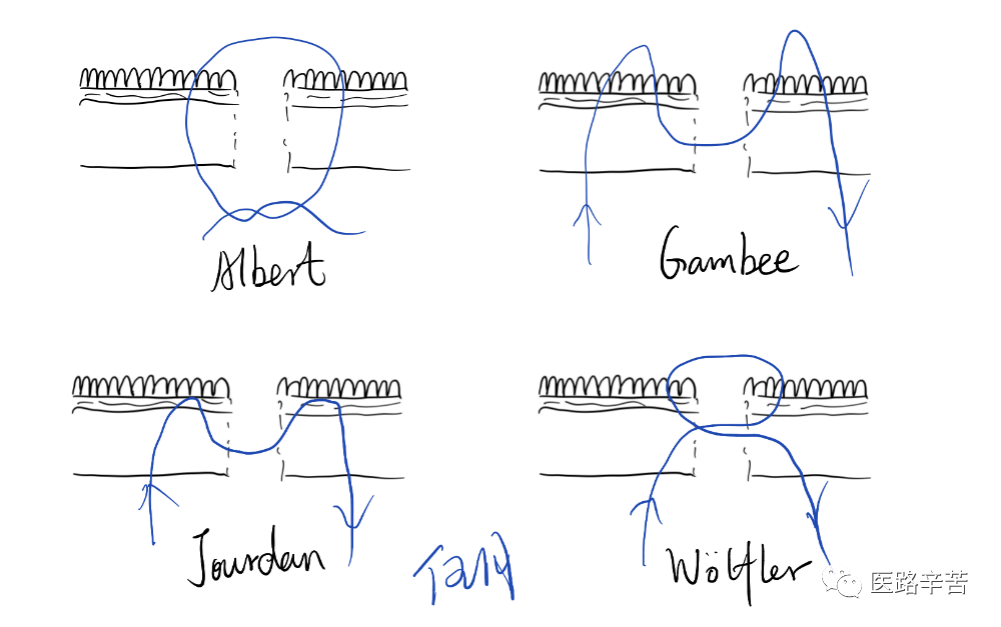 缝合线怎么消毒关于急诊清创缝合术必须掌握的知识_https://www.jmylbn.com_新闻资讯_第22张