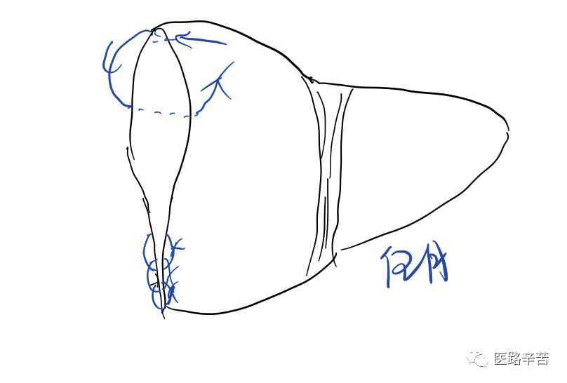 缝合线怎么消毒关于急诊清创缝合术必须掌握的知识_https://www.jmylbn.com_新闻资讯_第17张
