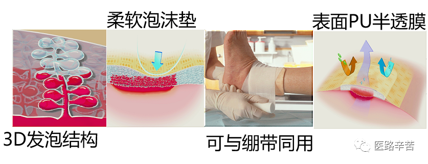 伤口贴敷料为什么伤口敷料的分类与选择技巧_https://www.jmylbn.com_新闻资讯_第12张