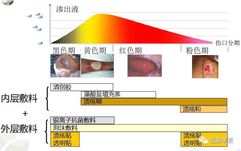 伤口贴敷料为什么伤口敷料的分类与选择技巧_https://www.jmylbn.com_新闻资讯_第22张