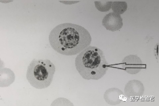 a中毒颗粒b.豪焦-小体c.棒状小体d.空泡变性e.杜氏小体15.精密度是()a.反映出
