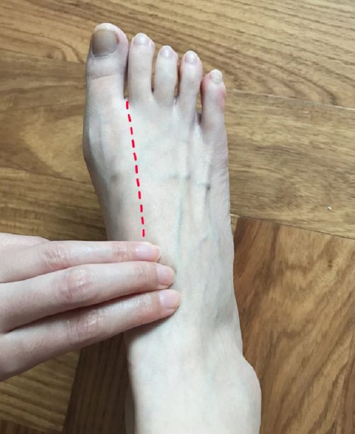 假如脉搏消失了,或者双侧足背动脉强度不一致,千万要提高警惕,前往