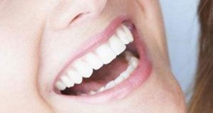 人生中的第三副牙齿——种植牙