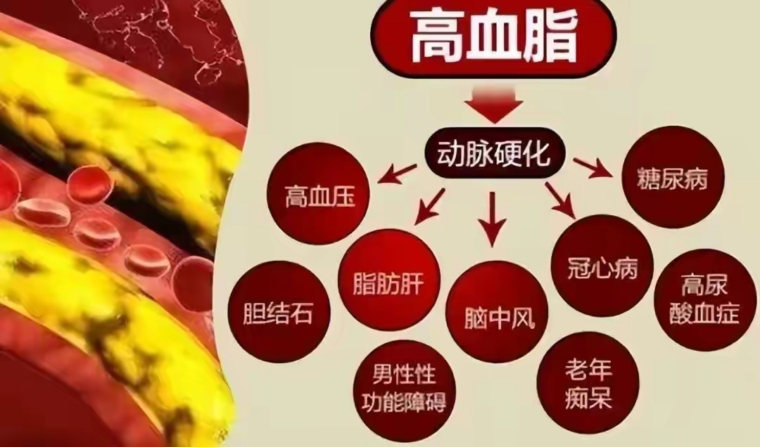 健康科普 | 高血脂，不可忽视的“隐形杀手”