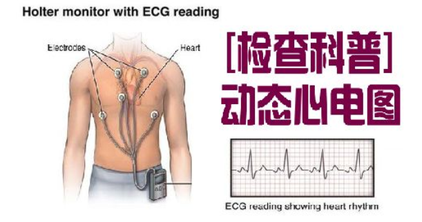 动态心电图系统怎么用新技术注入新能量——虞城县第一个7天长程动态心电系统落户淮海医院_https://www.jmylbn.com_新闻资讯_第8张