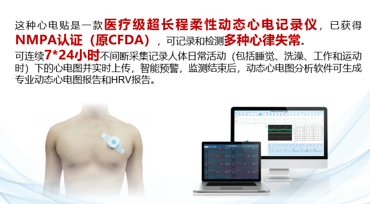 动态心电图系统怎么用新技术注入新能量——虞城县第一个7天长程动态心电系统落户淮海医院_https://www.jmylbn.com_新闻资讯_第15张