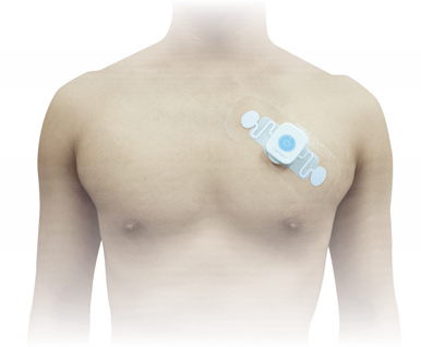 动态心电图系统怎么用新技术注入新能量——虞城县第一个7天长程动态心电系统落户淮海医院_https://www.jmylbn.com_新闻资讯_第6张