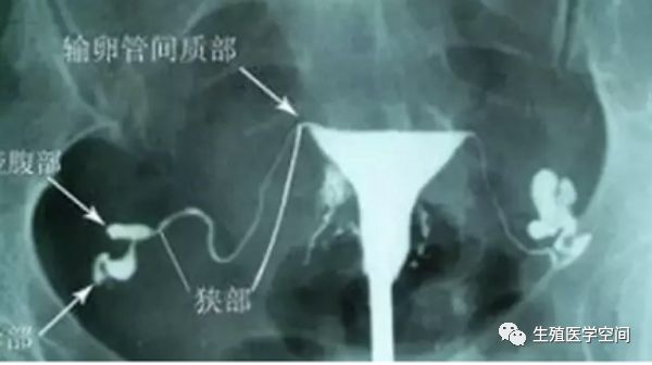 胎停育流产后,该做什么检查?-微信头条网 胎停育流产后,该做什么检查?