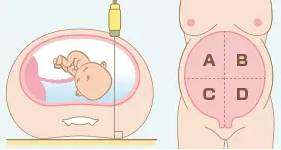 眼科ab超单怎么看来，手把手教你看懂孕检B超单！_https://www.jmylbn.com_新闻资讯_第3张