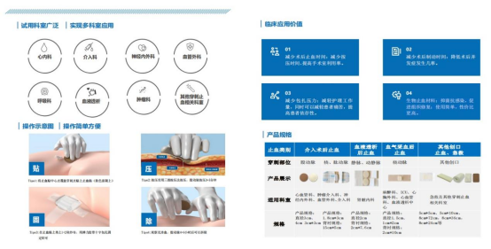 止血贴怎么贴提高患者舒适度，提高患者依存性，降低手术成本——动脉止血贴_https://www.jmylbn.com_新闻资讯_第2张