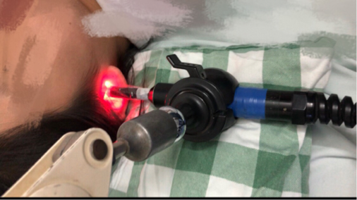 激光治疗仪有什么作用【科普小知识】超激光疼痛治疗仪的作用_https://www.jmylbn.com_新闻资讯_第15张