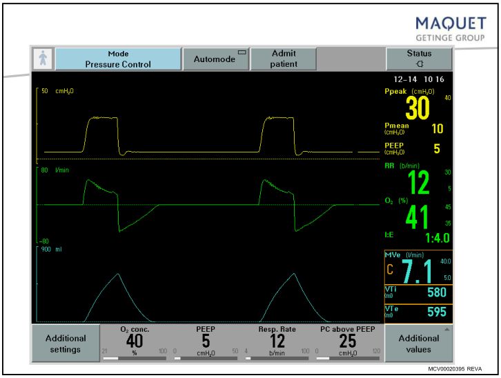 呼吸机呼吸压力怎么调呼吸机模式、参数设置误区、报警分析及纤支镜吸痰_https://www.jmylbn.com_新闻资讯_第10张