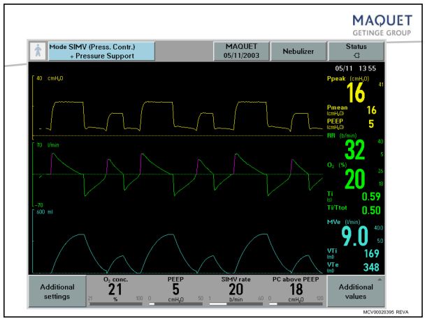 呼吸机怎么看不会设置呼吸机模式和参数？看完这篇快速上手！_https://www.jmylbn.com_新闻资讯_第28张
