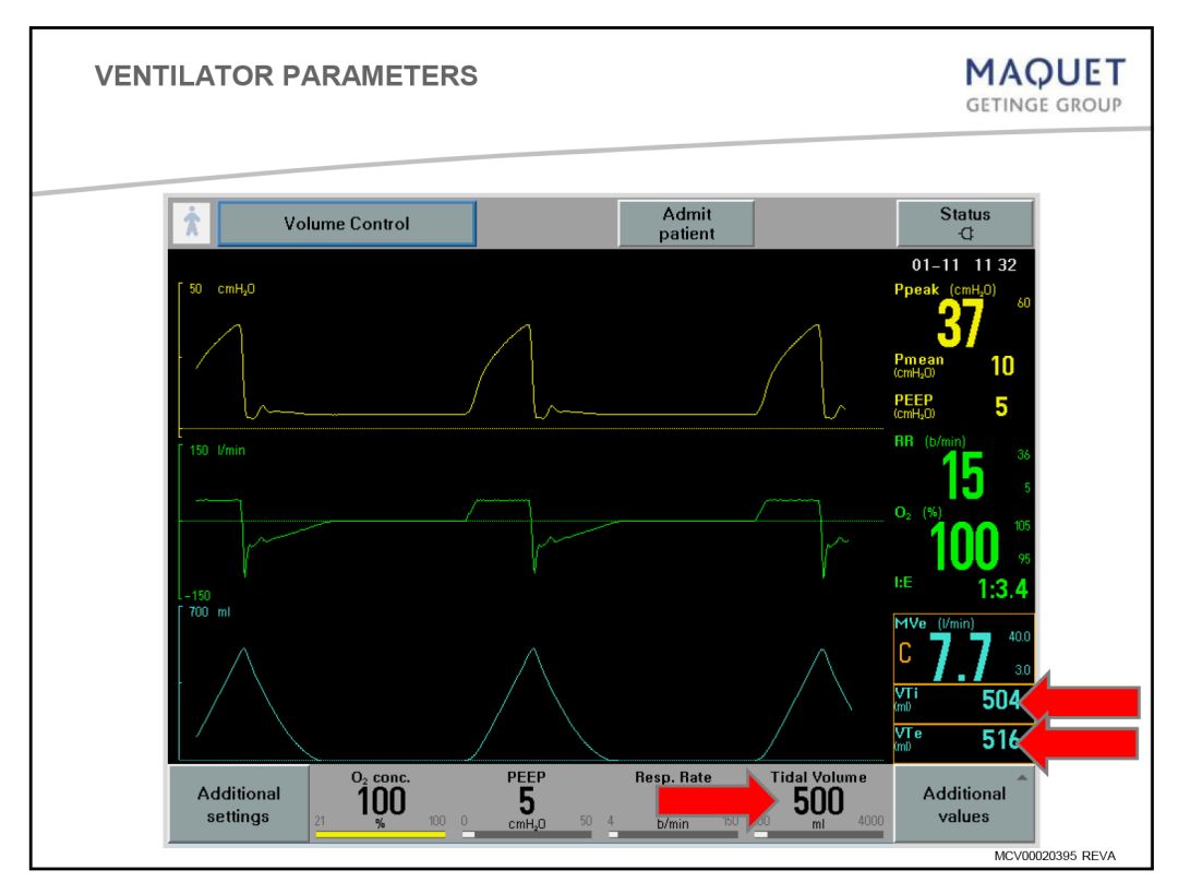 呼吸机压力怎么设置「基础篇」呼吸机模式及参数设置，快速上手！_https://www.jmylbn.com_新闻资讯_第6张