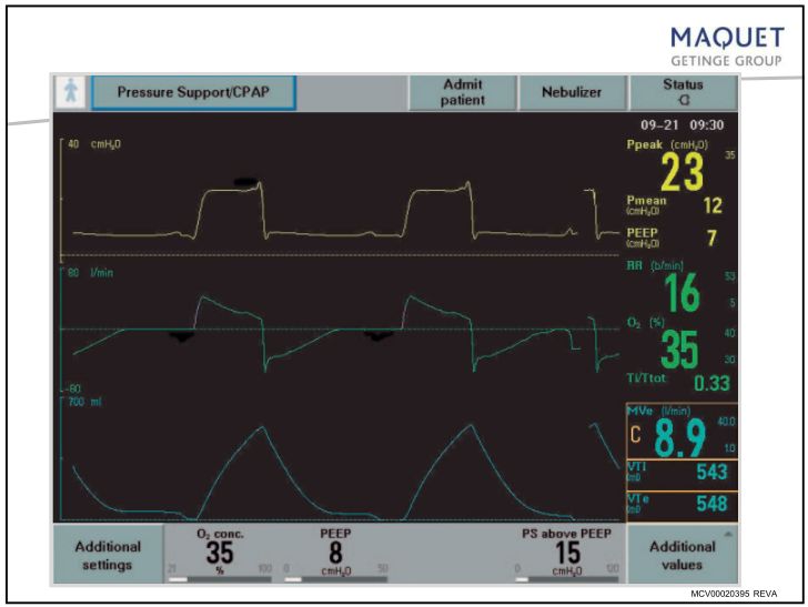 呼吸机怎么看不会设置呼吸机模式和参数？看完这篇快速上手！_https://www.jmylbn.com_新闻资讯_第20张