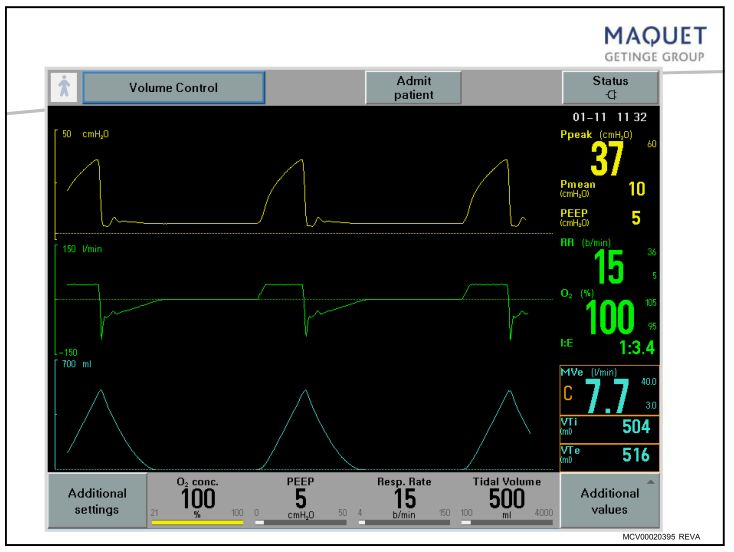 呼吸机呼吸压力怎么调呼吸机模式、参数设置误区、报警分析及纤支镜吸痰_https://www.jmylbn.com_新闻资讯_第8张
