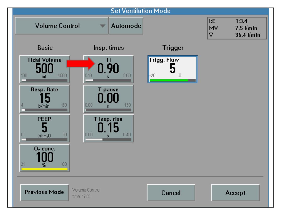 呼吸机呼吸压力怎么调呼吸机模式、参数设置误区、报警分析及纤支镜吸痰_https://www.jmylbn.com_新闻资讯_第9张
