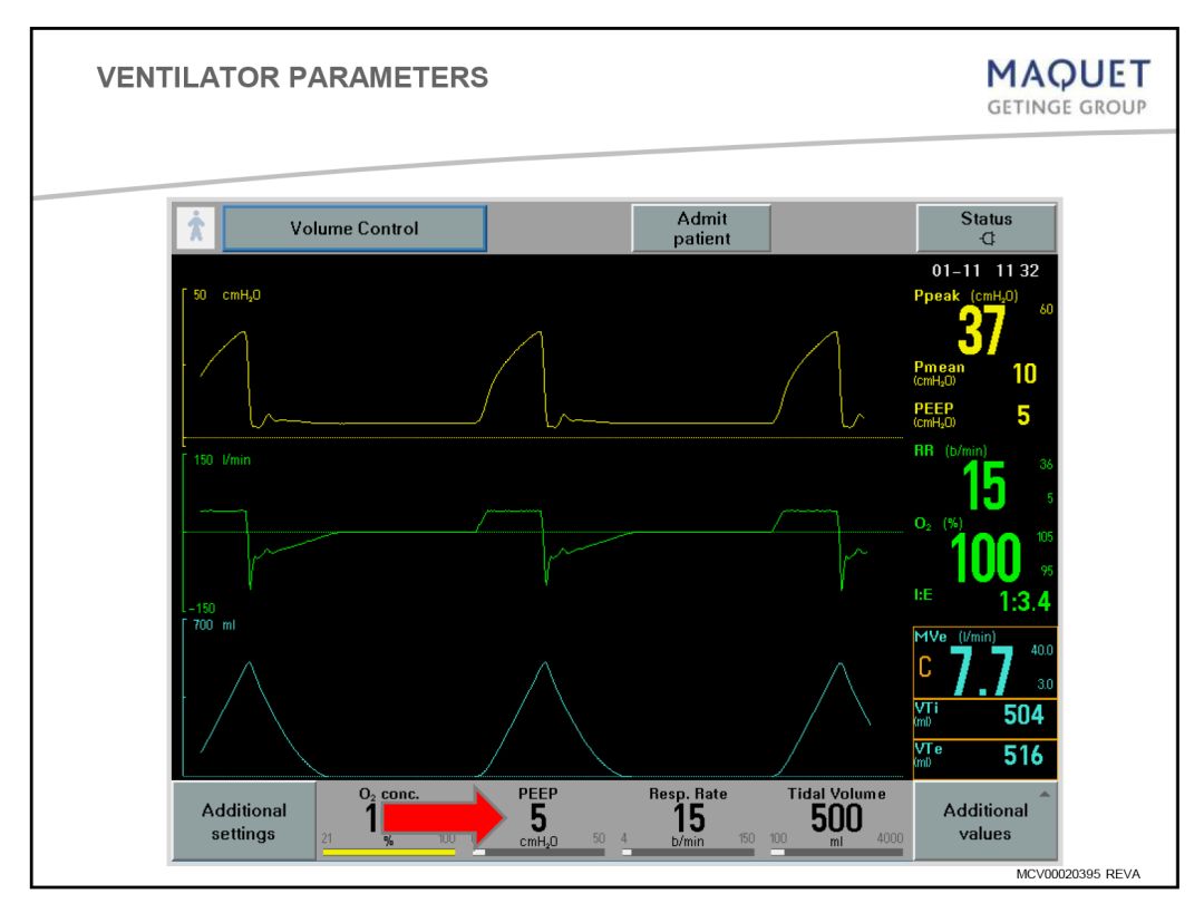 呼吸机怎么看呼吸机最全指南：让护士碰到呼吸机参数不再慌！_https://www.jmylbn.com_新闻资讯_第7张