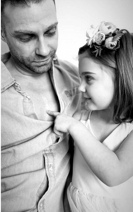 手术拉链怎么拆怀孕 33 周查出胎儿严重先心病，出生 3 天就开胸！4 岁女孩胸口的手术疤痕，爸爸竟纹了个一模一样的_https://www.jmylbn.com_新闻资讯_第1张