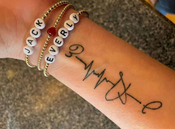 手术拉链怎么拆怀孕 33 周查出胎儿严重先心病，出生 3 天就开胸！4 岁女孩胸口的手术疤痕，爸爸竟纹了个一模一样的_https://www.jmylbn.com_新闻资讯_第5张