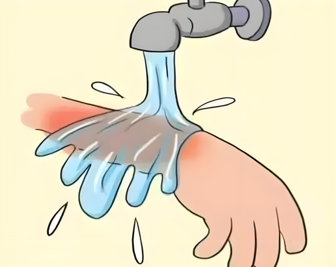 烫伤出现水泡要不要挑破?看完你就知道了!