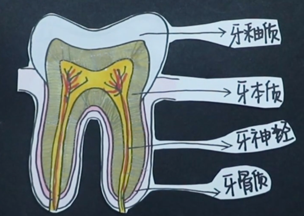 牙本质龋分层示意图图片