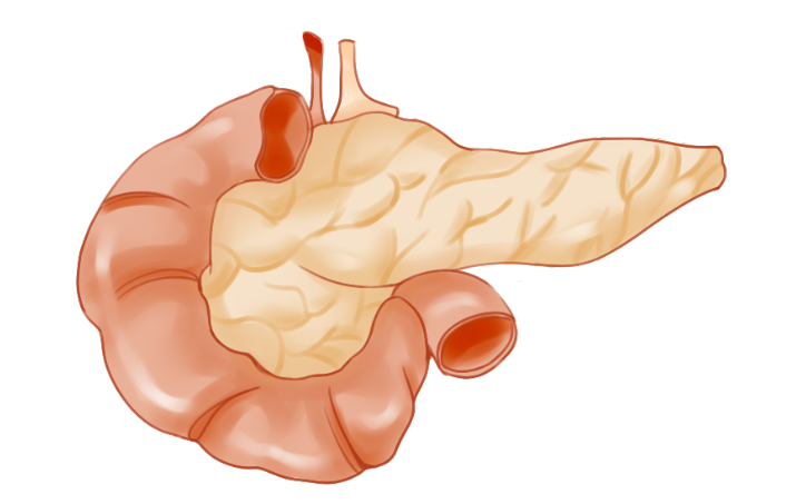 “癌中之王”胰腺癌的早期症状有哪些？