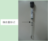 采血管分别采什么血你来问，我来答---真空采血管问几许？_https://www.jmylbn.com_新闻资讯_第5张