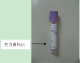 采血管分别采什么血你来问，我来答---真空采血管问几许？_https://www.jmylbn.com_新闻资讯_第3张