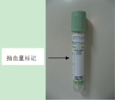 采血管分别采什么血你来问，我来答---真空采血管问几许？_https://www.jmylbn.com_新闻资讯_第4张