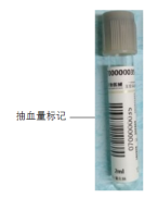 采血管分别采什么血你来问，我来答---真空采血管问几许？_https://www.jmylbn.com_新闻资讯_第10张