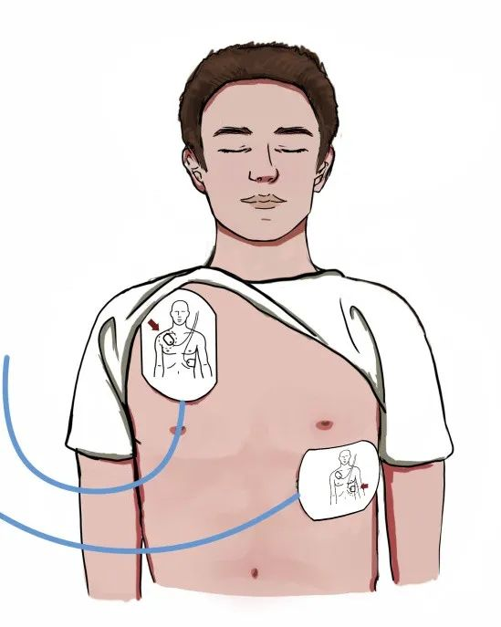 守护生命救在身边卧龙区召开自动体外除颤仪aed使用暨急救技能培训班