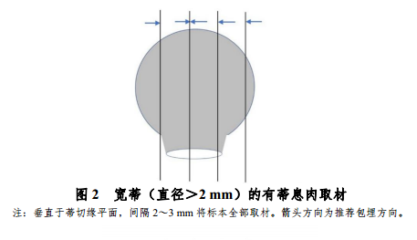 什么是放疗定位膜中国结直肠癌诊疗规范（2020）_https://www.jmylbn.com_新闻资讯_第8张
